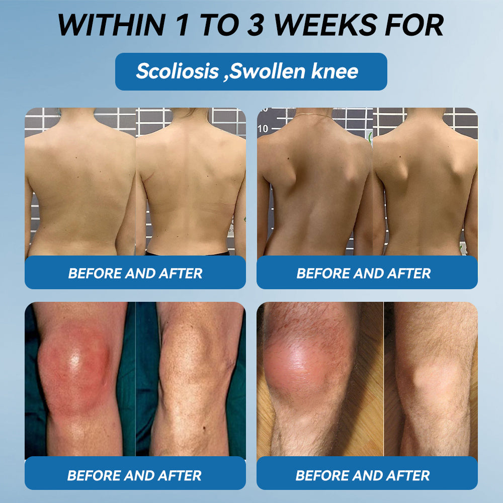 𝖯𝗂𝖼𝗱𝗼® BPC-157 Joint Healing Cream🦴Treats Arthritis, Neuropathy, Rheumatism, Sports Injuries & More👍upsell