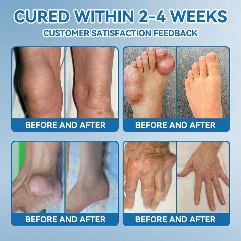 🦋𝖯𝗂𝖼𝗱𝗼® BPC-157 Joint Healing Cream🦴Treats Arthritis, Neuropathy, Rheumatism, Sports Injuries & More👍