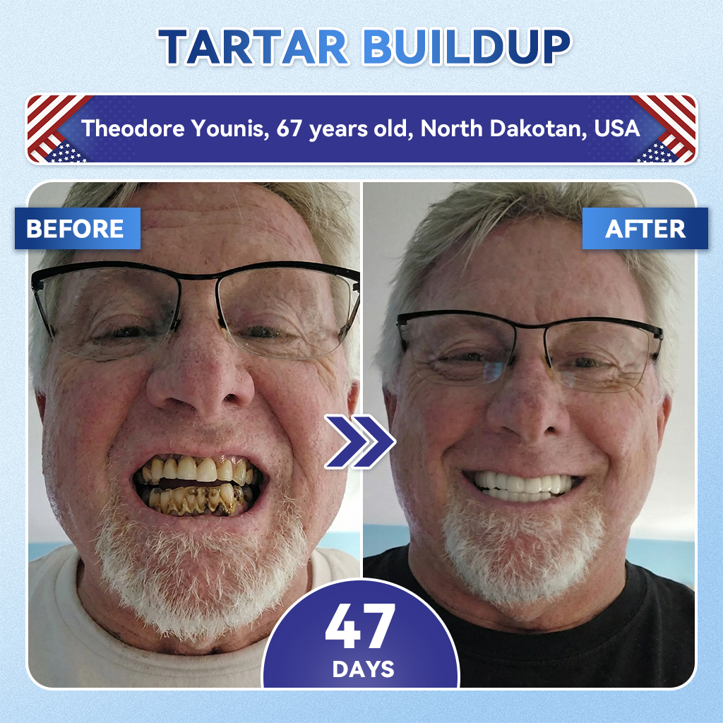 🦷𝐆𝐥𝐢𝐦𝐦𝐞𝐫𝐥𝐲® 𝐓𝐢𝐝𝐞𝐠𝐥𝐮𝐬𝐢𝐛 𝐓𝐨𝐨𝐭𝐡 & 𝐆𝐮𝐦 𝐑𝐞𝐩𝐚𝐢𝐫 𝐌𝐢𝐜𝐫𝐨𝐧𝐞𝐞𝐝𝐥𝐞 𝐏𝐚𝐭𝐜𝐡  | 𝐀𝐝𝐯𝐚𝐧𝐜𝐞𝐝 𝐒𝐭𝐞𝐦-𝐂𝐞𝐥𝐥 𝐀𝐜𝐭𝐢𝐯𝐚𝐭𝐢𝐨𝐧 𝐓𝐞𝐞𝐭𝐡 𝐒𝐭𝐫𝐢𝐩𝐬(🦷𝐑𝐞𝐛𝐮𝐢𝐥𝐝 𝐄𝐧𝐚𝐦𝐞𝐥 & 𝐃𝐞𝐧𝐭𝐢𝐧 • 𝐒𝐭𝐫𝐞𝐧𝐠𝐭𝐡𝐞𝐧 𝐆𝐮𝐦𝐬 • 𝐄𝐫𝐚𝐝𝐢𝐜𝐚𝐭𝐞 𝐓𝐚𝐫𝐭𝐚𝐫 & 𝐎𝐝𝐨𝐫 • 𝐒𝐭𝐨𝐩 𝐓𝐨𝐨𝐭𝐡 𝐒𝐞𝐧𝐬𝐢𝐭𝐢𝐯𝐢𝐭𝐲)
