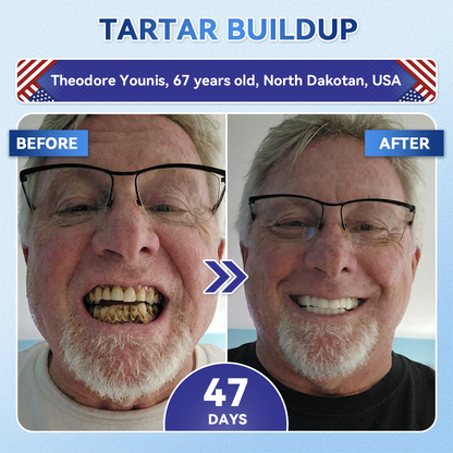 🦷𝐆𝐥𝐢𝐦𝐦𝐞𝐫𝐥𝐲® 𝐓𝐢𝐝𝐞𝐠𝐥𝐮𝐬𝐢𝐛 𝐓𝐨𝐨𝐭𝐡 & 𝐆𝐮𝐦 𝐑𝐞𝐩𝐚𝐢𝐫 𝐌𝐢𝐜𝐫𝐨𝐧𝐞𝐞𝐝𝐥𝐞 𝐏𝐚𝐭𝐜𝐡  | 𝐀𝐝𝐯𝐚𝐧𝐜𝐞𝐝 𝐒𝐭𝐞𝐦-𝐂𝐞𝐥𝐥 𝐀𝐜𝐭𝐢𝐯𝐚𝐭𝐢𝐨𝐧 𝐓𝐞𝐞𝐭𝐡 𝐒𝐭𝐫𝐢𝐩𝐬(🦷𝐑𝐞𝐛𝐮𝐢𝐥𝐝 𝐄𝐧𝐚𝐦𝐞𝐥 & 𝐃𝐞𝐧𝐭𝐢𝐧 • 𝐒𝐭𝐫𝐞𝐧𝐠𝐭𝐡𝐞𝐧 𝐆𝐮𝐦𝐬 • 𝐄𝐫𝐚𝐝𝐢𝐜𝐚𝐭𝐞 𝐓𝐚𝐫𝐭𝐚𝐫 & 𝐎𝐝𝐨𝐫 • 𝐒𝐭𝐨𝐩 𝐓𝐨𝐨𝐭𝐡 𝐒𝐞𝐧𝐬𝐢𝐭𝐢𝐯𝐢𝐭𝐲)