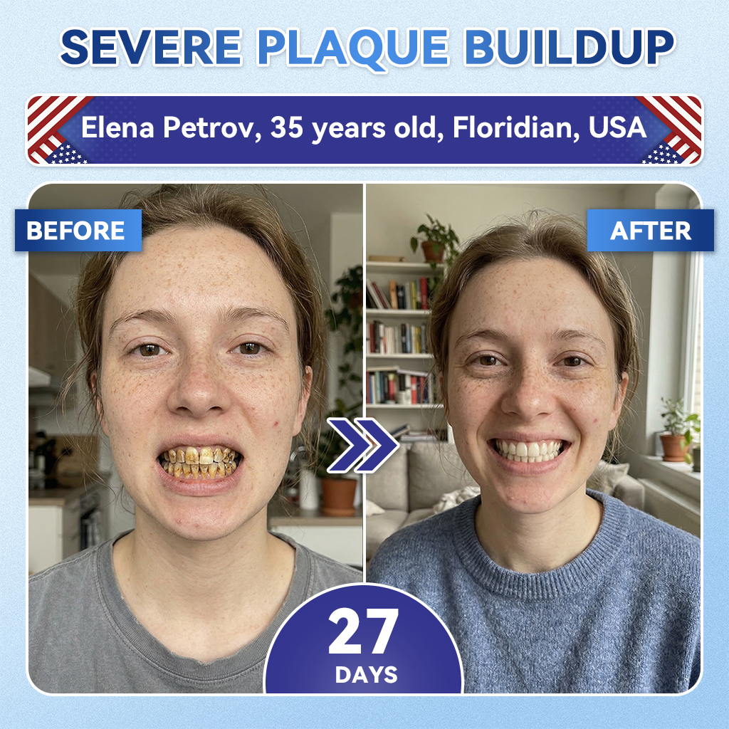 🦷𝐆𝐥𝐢𝐦𝐦𝐞𝐫𝐥𝐲® 𝐓𝐢𝐝𝐞𝐠𝐥𝐮𝐬𝐢𝐛 𝐓𝐨𝐨𝐭𝐡 & 𝐆𝐮𝐦 𝐑𝐞𝐩𝐚𝐢𝐫 𝐌𝐢𝐜𝐫𝐨𝐧𝐞𝐞𝐝𝐥𝐞 𝐏𝐚𝐭𝐜𝐡  | 𝐀𝐝𝐯𝐚𝐧𝐜𝐞𝐝 𝐒𝐭𝐞𝐦-𝐂𝐞𝐥𝐥 𝐀𝐜𝐭𝐢𝐯𝐚𝐭𝐢𝐨𝐧 𝐓𝐞𝐞𝐭𝐡 𝐒𝐭𝐫𝐢𝐩𝐬(🦷𝐑𝐞𝐛𝐮𝐢𝐥𝐝 𝐄𝐧𝐚𝐦𝐞𝐥 & 𝐃𝐞𝐧𝐭𝐢𝐧 • 𝐒𝐭𝐫𝐞𝐧𝐠𝐭𝐡𝐞𝐧 𝐆𝐮𝐦𝐬 • 𝐄𝐫𝐚𝐝𝐢𝐜𝐚𝐭𝐞 𝐓𝐚𝐫𝐭𝐚𝐫 & 𝐎𝐝𝐨𝐫 • 𝐒𝐭𝐨𝐩 𝐓𝐨𝐨𝐭𝐡 𝐒𝐞𝐧𝐬𝐢𝐭𝐢𝐯𝐢𝐭𝐲)