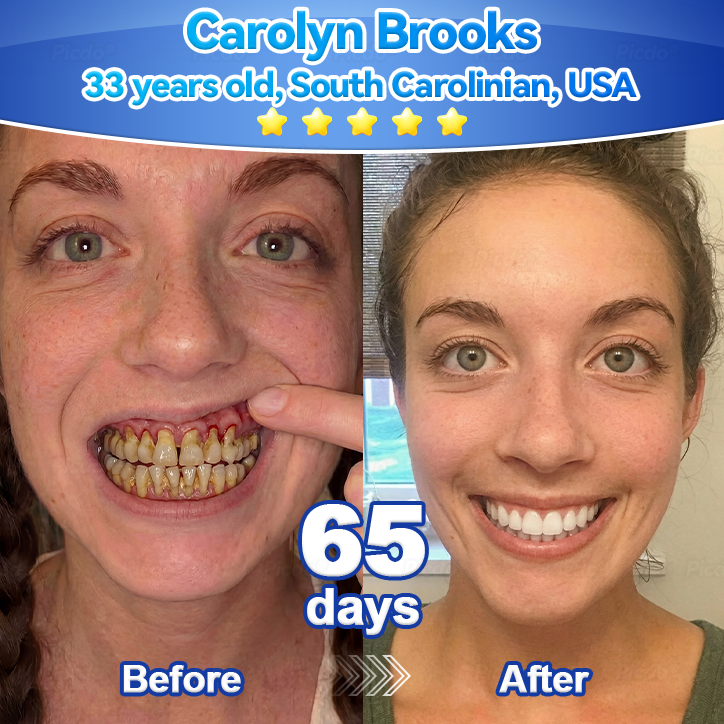 𝑃𝑖𝑐𝑑𝑜®👑🦷 𝑆𝑡𝑒𝑚 𝐶𝑒𝑙𝑙 𝐺𝑖𝑛𝑔𝑖𝑣𝑎𝑙 𝑅𝑒𝑝𝑎𝑖𝑟 𝑀𝑜𝑢𝑠𝑠𝑒(🦷Remove Tartar • Strengthen Gums • Deep Clean & Freshen Breath)🦹