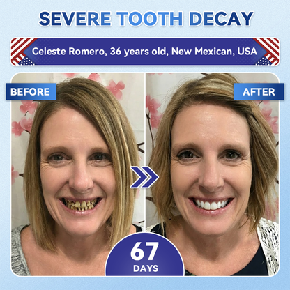 🦷𝐆𝐥𝐢𝐦𝐦𝐞𝐫𝐥𝐲® 𝐓𝐢𝐝𝐞𝐠𝐥𝐮𝐬𝐢𝐛 𝐓𝐨𝐨𝐭𝐡 & 𝐆𝐮𝐦 𝐑𝐞𝐩𝐚𝐢𝐫 𝐌𝐢𝐜𝐫𝐨𝐧𝐞𝐞𝐝𝐥𝐞 𝐏𝐚𝐭𝐜𝐡  | 𝐀𝐝𝐯𝐚𝐧𝐜𝐞𝐝 𝐒𝐭𝐞𝐦-𝐂𝐞𝐥𝐥 𝐀𝐜𝐭𝐢𝐯𝐚𝐭𝐢𝐨𝐧 𝐓𝐞𝐞𝐭𝐡 𝐒𝐭𝐫𝐢𝐩𝐬(🦷𝐑𝐞𝐛𝐮𝐢𝐥𝐝 𝐄𝐧𝐚𝐦𝐞𝐥 & 𝐃𝐞𝐧𝐭𝐢𝐧 • 𝐒𝐭𝐫𝐞𝐧𝐠𝐭𝐡𝐞𝐧 𝐆𝐮𝐦𝐬 • 𝐄𝐫𝐚𝐝𝐢𝐜𝐚𝐭𝐞 𝐓𝐚𝐫𝐭𝐚𝐫 & 𝐎𝐝𝐨𝐫 • 𝐒𝐭𝐨𝐩 𝐓𝐨𝐨𝐭𝐡 𝐒𝐞𝐧𝐬𝐢𝐭𝐢𝐯𝐢𝐭𝐲)