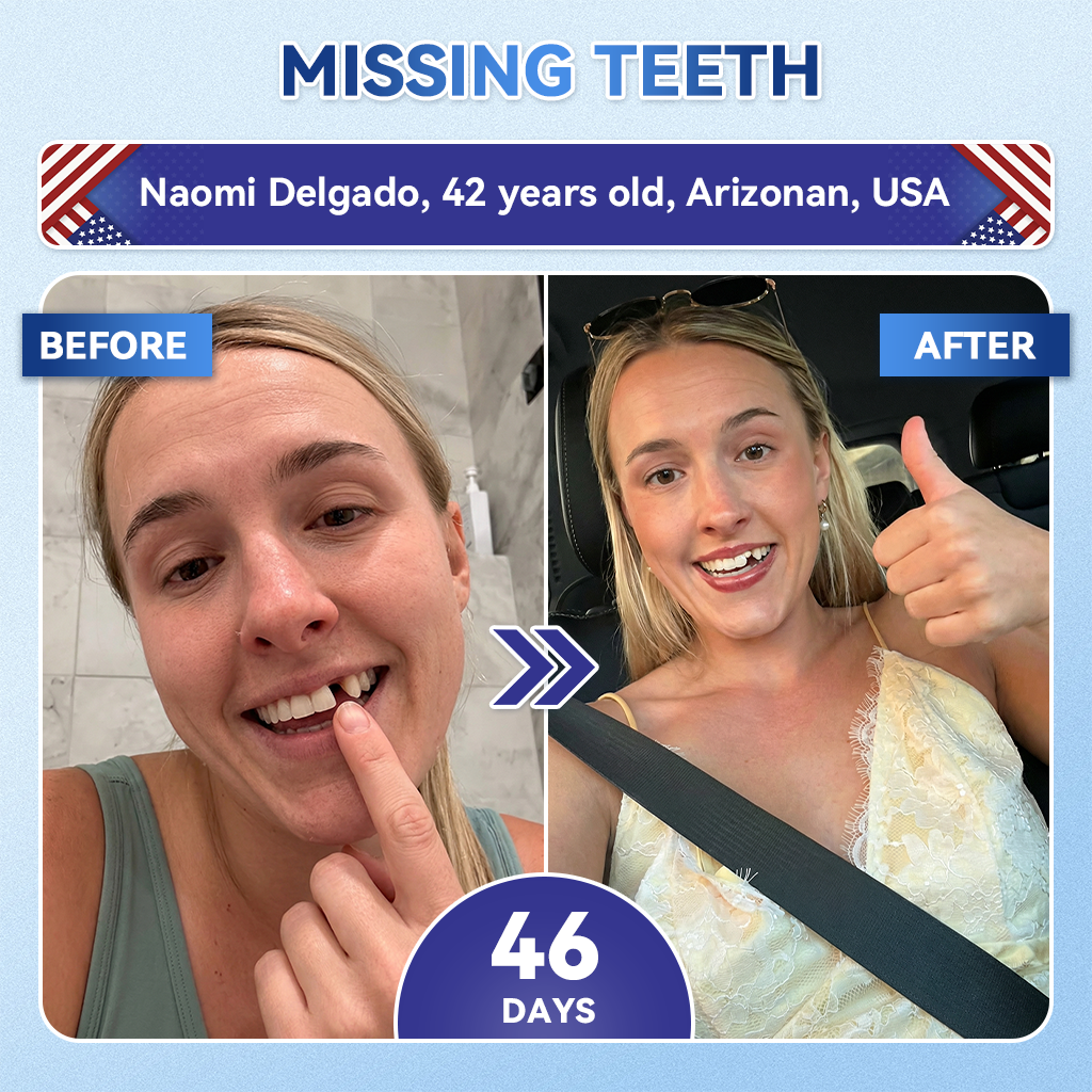 𝐺𝑙𝑖𝑚𝑚𝑒𝑟𝑙𝑦® 🔎𝑇𝑖𝑑𝑒𝑔𝑙𝑢𝑠𝑖𝑏 𝑇𝑜𝑜𝑡ℎ & 𝐺𝑢𝑚 𝑅𝑒𝑝𝑎𝑖𝑟 𝐹𝑎𝑠𝑡-𝐷𝑖𝑠𝑠𝑜𝑙𝑣𝑖𝑛𝑔 𝑂𝑟𝑎𝑙 𝑆𝑡𝑟𝑖𝑝𝑠🦷