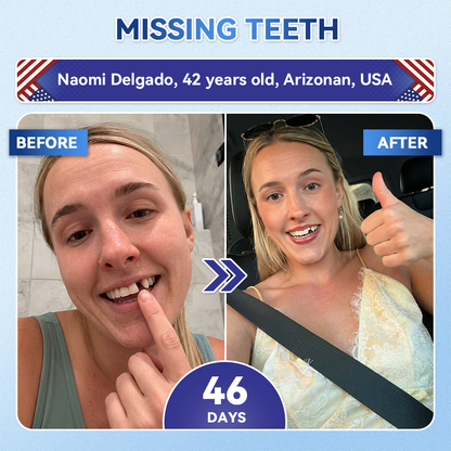 🦷𝐆𝐥𝐢𝐦𝐦𝐞𝐫𝐥𝐲® 𝐓𝐢𝐝𝐞𝐠𝐥𝐮𝐬𝐢𝐛 𝐓𝐨𝐨𝐭𝐡 & 𝐆𝐮𝐦 𝐑𝐞𝐩𝐚𝐢𝐫 𝐌𝐢𝐜𝐫𝐨𝐧𝐞𝐞𝐝𝐥𝐞 𝐏𝐚𝐭𝐜𝐡  | 𝐀𝐝𝐯𝐚𝐧𝐜𝐞𝐝 𝐒𝐭𝐞𝐦-𝐂𝐞𝐥𝐥 𝐀𝐜𝐭𝐢𝐯𝐚𝐭𝐢𝐨𝐧 𝐓𝐞𝐞𝐭𝐡 𝐒𝐭𝐫𝐢𝐩𝐬(🦷𝐑𝐞𝐛𝐮𝐢𝐥𝐝 𝐄𝐧𝐚𝐦𝐞𝐥 & 𝐃𝐞𝐧𝐭𝐢𝐧 • 𝐒𝐭𝐫𝐞𝐧𝐠𝐭𝐡𝐞𝐧 𝐆𝐮𝐦𝐬 • 𝐄𝐫𝐚𝐝𝐢𝐜𝐚𝐭𝐞 𝐓𝐚𝐫𝐭𝐚𝐫 & 𝐎𝐝𝐨𝐫 • 𝐒𝐭𝐨𝐩 𝐓𝐨𝐨𝐭𝐡 𝐒𝐞𝐧𝐬𝐢𝐭𝐢𝐯𝐢𝐭𝐲)