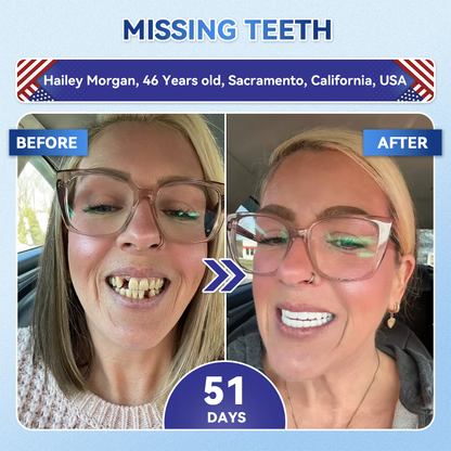 🦷𝐆𝐥𝐢𝐦𝐦𝐞𝐫𝐥𝐲® 𝐓𝐢𝐝𝐞𝐠𝐥𝐮𝐬𝐢𝐛 𝐓𝐨𝐨𝐭𝐡 & 𝐆𝐮𝐦 𝐑𝐞𝐩𝐚𝐢𝐫 𝐌𝐢𝐜𝐫𝐨𝐧𝐞𝐞𝐝𝐥𝐞 𝐏𝐚𝐭𝐜𝐡  | 𝐀𝐝𝐯𝐚𝐧𝐜𝐞𝐝 𝐒𝐭𝐞𝐦-𝐂𝐞𝐥𝐥 𝐀𝐜𝐭𝐢𝐯𝐚𝐭𝐢𝐨𝐧 𝐓𝐞𝐞𝐭𝐡 𝐒𝐭𝐫𝐢𝐩𝐬(🦷𝐑𝐞𝐛𝐮𝐢𝐥𝐝 𝐄𝐧𝐚𝐦𝐞𝐥 & 𝐃𝐞𝐧𝐭𝐢𝐧 • 𝐒𝐭𝐫𝐞𝐧𝐠𝐭𝐡𝐞𝐧 𝐆𝐮𝐦𝐬 • 𝐄𝐫𝐚𝐝𝐢𝐜𝐚𝐭𝐞 𝐓𝐚𝐫𝐭𝐚𝐫 & 𝐎𝐝𝐨𝐫 • 𝐒𝐭𝐨𝐩 𝐓𝐨𝐨𝐭𝐡 𝐒𝐞𝐧𝐬𝐢𝐭𝐢𝐯𝐢𝐭𝐲)
