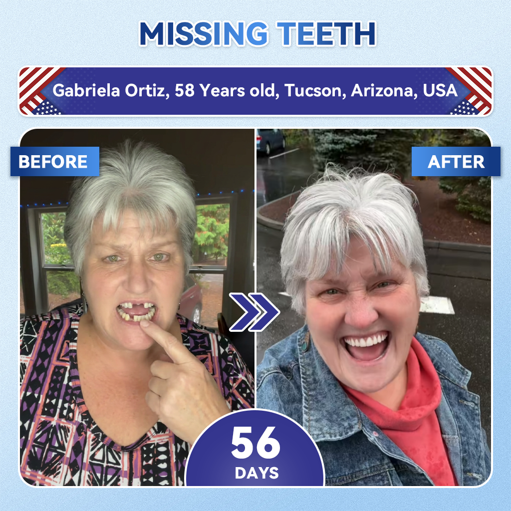 🦷𝐆𝐥𝐢𝐦𝐦𝐞𝐫𝐥𝐲® 𝐓𝐢𝐝𝐞𝐠𝐥𝐮𝐬𝐢𝐛 𝐓𝐨𝐨𝐭𝐡 & 𝐆𝐮𝐦 𝐑𝐞𝐩𝐚𝐢𝐫 𝐌𝐢𝐜𝐫𝐨𝐧𝐞𝐞𝐝𝐥𝐞 𝐏𝐚𝐭𝐜𝐡  | 𝐀𝐝𝐯𝐚𝐧𝐜𝐞𝐝 𝐒𝐭𝐞𝐦-𝐂𝐞𝐥𝐥 𝐀𝐜𝐭𝐢𝐯𝐚𝐭𝐢𝐨𝐧 𝐓𝐞𝐞𝐭𝐡 𝐒𝐭𝐫𝐢𝐩𝐬(🦷𝐑𝐞𝐛𝐮𝐢𝐥𝐝 𝐄𝐧𝐚𝐦𝐞𝐥 & 𝐃𝐞𝐧𝐭𝐢𝐧 • 𝐒𝐭𝐫𝐞𝐧𝐠𝐭𝐡𝐞𝐧 𝐆𝐮𝐦𝐬 • 𝐄𝐫𝐚𝐝𝐢𝐜𝐚𝐭𝐞 𝐓𝐚𝐫𝐭𝐚𝐫 & 𝐎𝐝𝐨𝐫 • 𝐒𝐭𝐨𝐩 𝐓𝐨𝐨𝐭𝐡 𝐒𝐞𝐧𝐬𝐢𝐭𝐢𝐯𝐢𝐭𝐲)