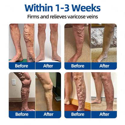 ✅𝐅𝐥𝐨𝐫𝐢𝐬𝐦𝐚® 𝐕𝐞𝐢𝐧𝐓𝐚𝐫𝐠𝐞𝐭 𝐌𝐢𝐜𝐫𝐨𝐧𝐞𝐞𝐝𝐥𝐞 𝐏𝐚𝐭𝐜𝐡📘Instant Relief, Long-Term Results