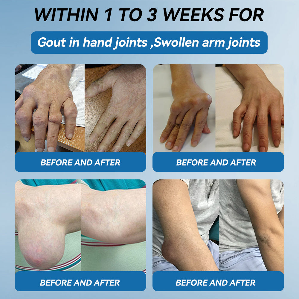 🦋𝖯𝗂𝖼𝗱𝗼® BPC-157 Joint Healing Cream🦴Treats Arthritis, Neuropathy, Rheumatism, Sports Injuries & More👍