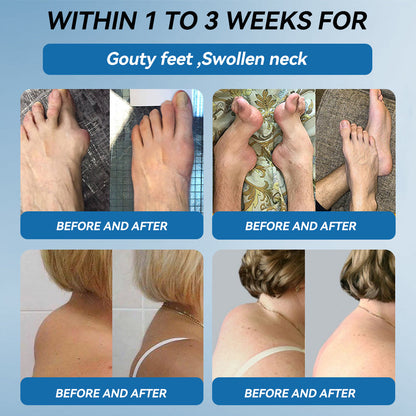 🦋𝖯𝗂𝖼𝗱𝗼® BPC-157 Joint Healing Cream🦴Treats Arthritis, Neuropathy, Rheumatism, Sports Injuries & More👍