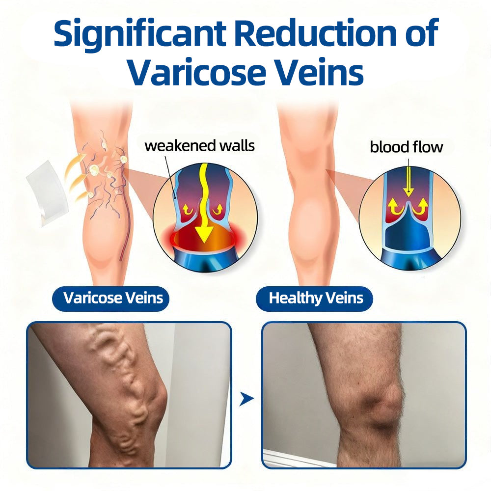 ✅𝐅𝐥𝐨𝐫𝐢𝐬𝐦𝐚® 𝐕𝐞𝐢𝐧𝐓𝐚𝐫𝐠𝐞𝐭 𝐌𝐢𝐜𝐫𝐨𝐧𝐞𝐞𝐝𝐥𝐞 𝐏𝐚𝐭𝐜𝐡📘Instant Relief, Long-Term Results
