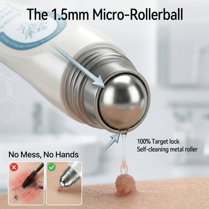 𝐏i𝐜𝐝o® 7-𝐷𝑎𝑦 𝗧𝐚𝐠 & 𝗦𝗽𝐨𝐭 𝐄𝐫𝒂𝒔𝒆𝒓(Zero Pain, Zero 𝐒𝐜𝐚𝒓𝒔 Rollerball)🌳🌳