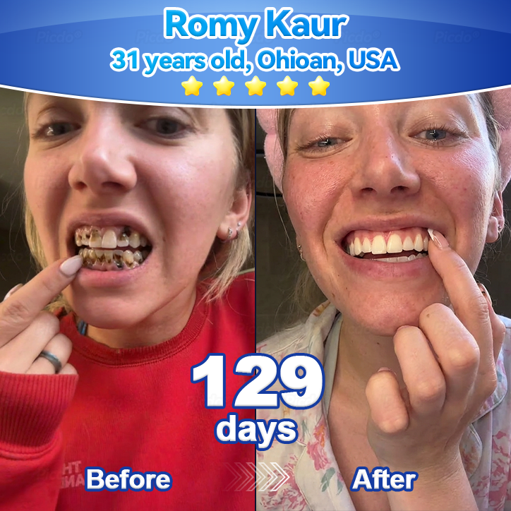 𝑃𝑖𝑐𝑑𝑜®👑🦷 𝑆𝑡𝑒𝑚 𝐶𝑒𝑙𝑙 𝐺𝑖𝑛𝑔𝑖𝑣𝑎𝑙 𝑅𝑒𝑝𝑎𝑖𝑟 𝑀𝑜𝑢𝑠𝑠𝑒(🦷Remove Tartar • Strengthen Gums • Deep Clean & Freshen Breath)🦹